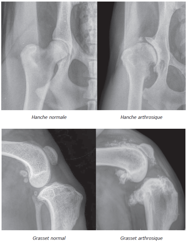hanche-grasset-arthrosique.png