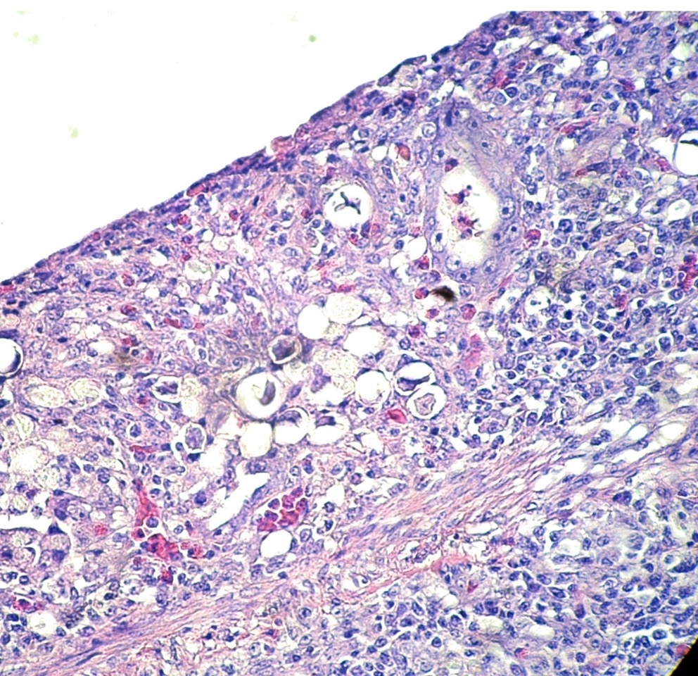 Coupe histologique x40 HE Coccidiose.jpeg