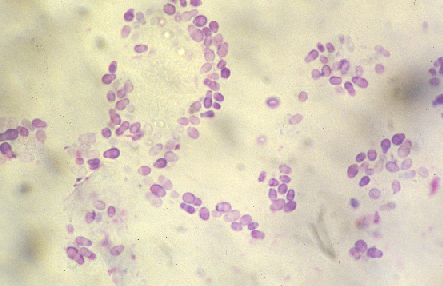 cytologie-dysbiose.png