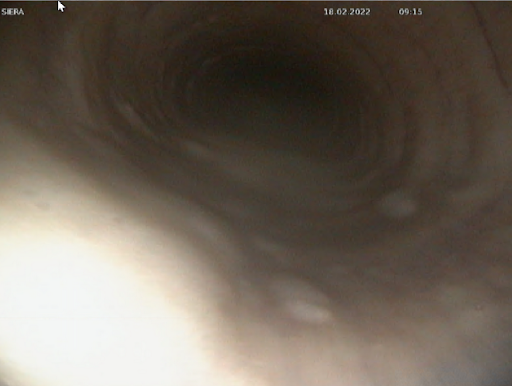 img-endoscopie-1.png